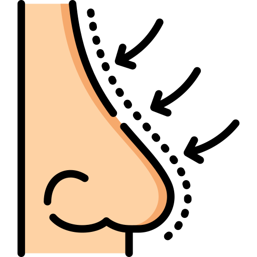 Rhinoplasty